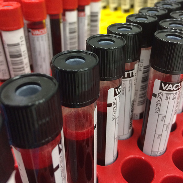 Röhrchen mit Blutspenden